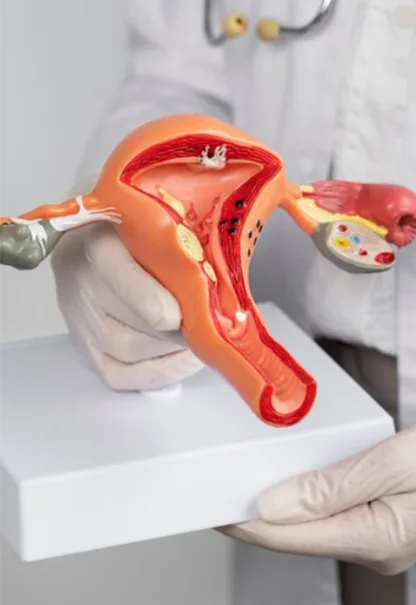 endometrial-polip-02