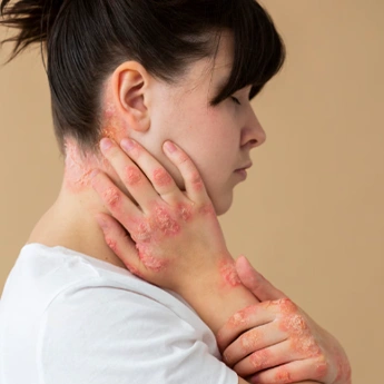 HPV Testi Nasıl Yapılır?